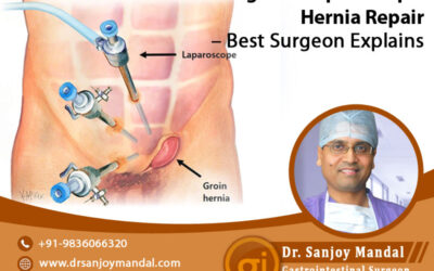 Advantages of Laparoscopic Hernia Surgery – Best Surgeon Explains