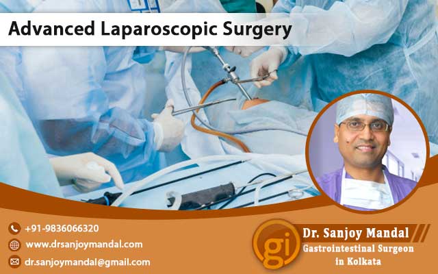 best laparoscopic surgeon in Kolkata