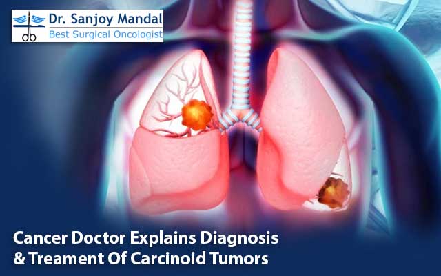 Cancer Doctor Explains Diagnosis & Treatment Of Carcinoid Tumors