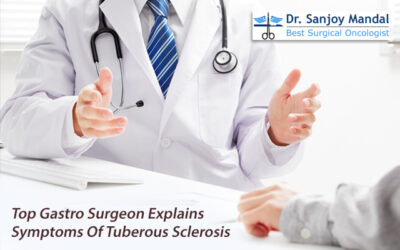 Top Gastro Surgeon Explains Symptoms Of Tuberous Sclerosis