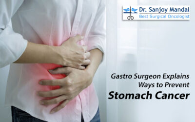 Gastro Surgeon Explains Ways to Prevent Stomach Cancer