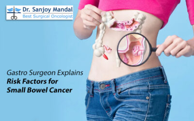 Gastro Surgeon Explains Risk Factors for Small Bowel Cancer