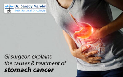 GI surgeon explains the causes & treatment of stomach cancer