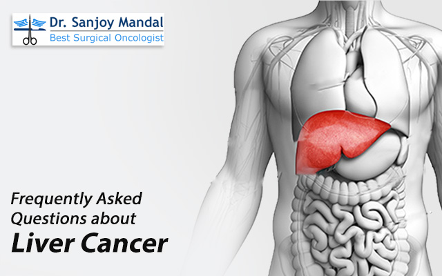 Frequently Asked Questions about Liver Cancer