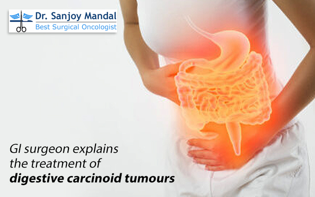 GI surgeon explains the treatment of digestive carcinoid tumours