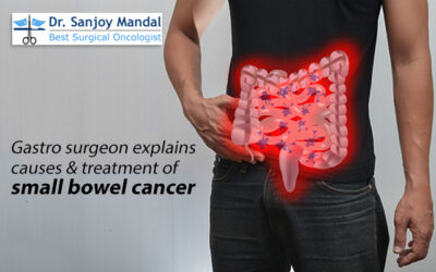 Gastro surgeon explains causes & treatment of small bowel cancer