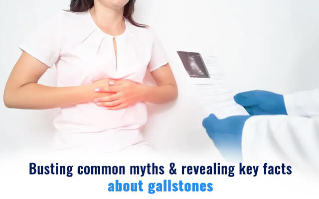 Common myths & key facts about Gallstones