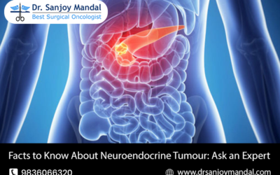 Facts to Know About Neuroendocrine Tumour: Ask an Expert