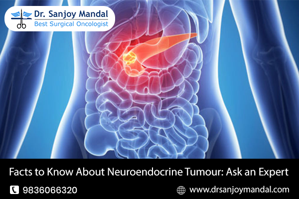 best neuroendocrine tumour treatment doctor in Saltlake, Kolkata