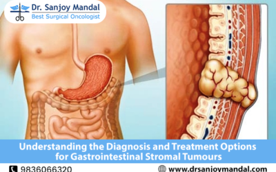 Understanding the Diagnosis and Treatment Options for Gastrointestinal Stromal Tumours