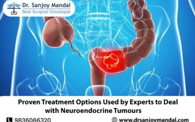 Proven Treatment Options Used by Experts to Deal with Neuroendocrine Tumours
