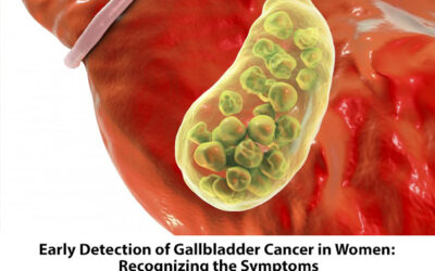 Early Detection of Gallbladder Cancer in Women: Recognizing the Symptoms