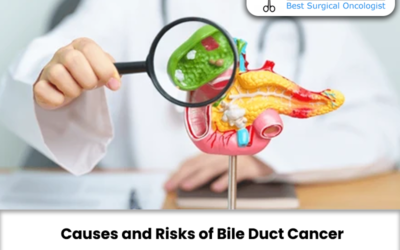 Causes and Risks of Bile Duct Cancer