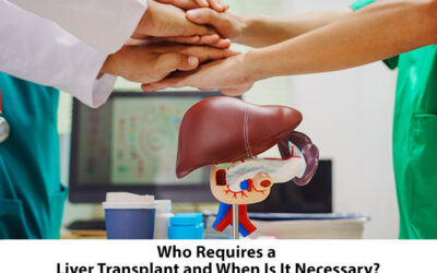 Who Requires a Liver Transplant and When Is It Necessary?