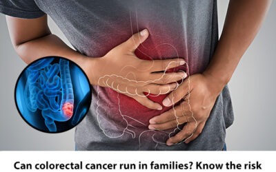 Can Colorectal Cancer Run in Families? Know the Risk