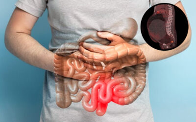 Signs and Symptoms of Retroperitoneal Tumours: When to Seek a GI Surgeon’s Help
