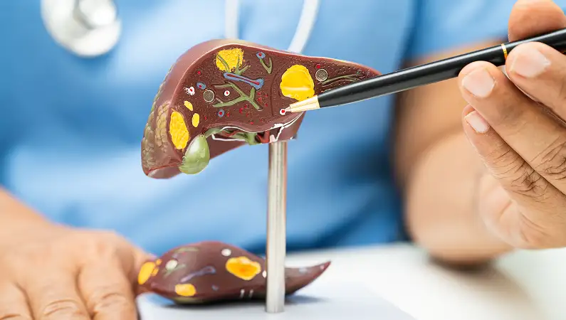 Gallbladder Cancer
